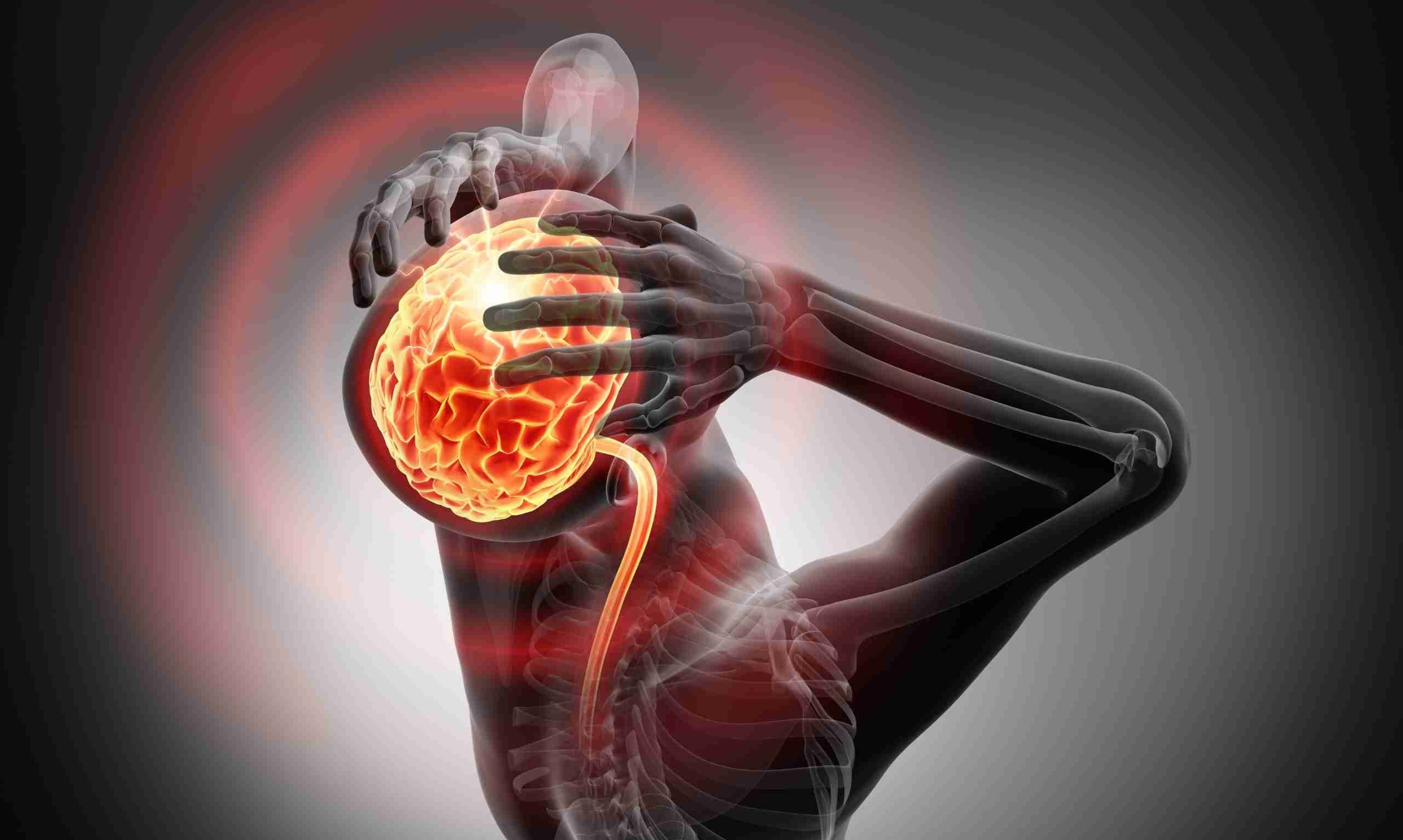 فشار مغز چیست و بالارفتن آن چه خطراتی دارد؟