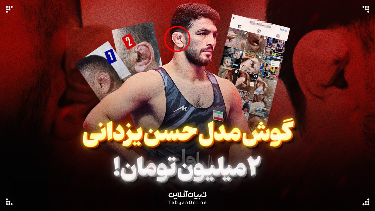 گوش مدل حسن یزدانی ۲ میلیون تومان!