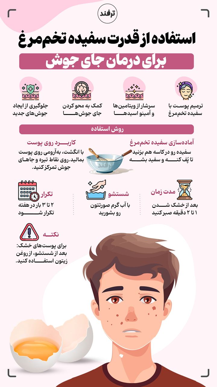  استفاده از قدرت سفیده تخم مرغ برای درمان جای جوش