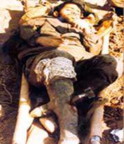انفجار در اتاق عمل