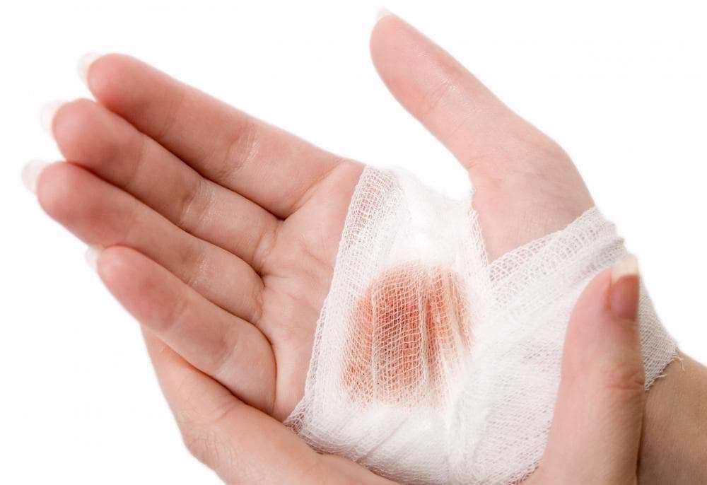 چگونگی تسریع جوش خوردن زخم‌ها