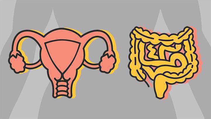 سرطان تخمدان یا سندرم روده تحریک‌پذیر؟