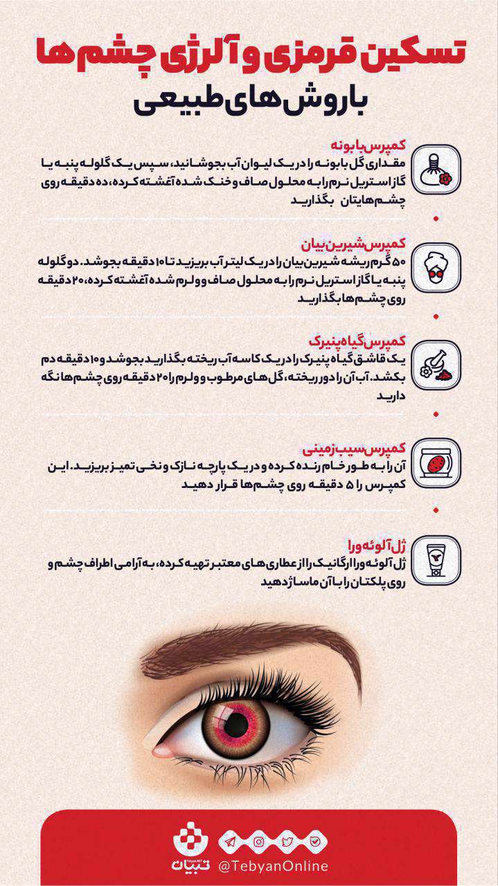 تسکین قرمزی چشم و آلرژی چشم ها با روش های طبیعی؛ اینفوگرافیک