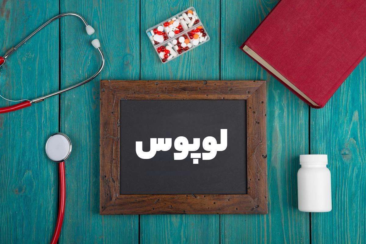 پاسخ به سوالات رایج درباره لوپوس