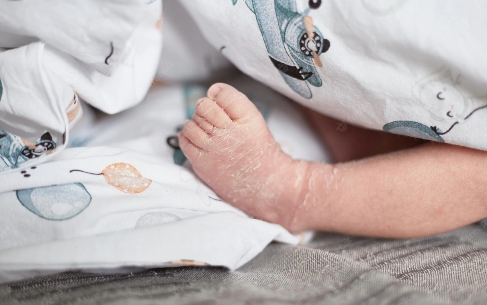 کم‌آبی در نوزادان؛ خطرناک‌تر از آنچه فکر می‌کنید