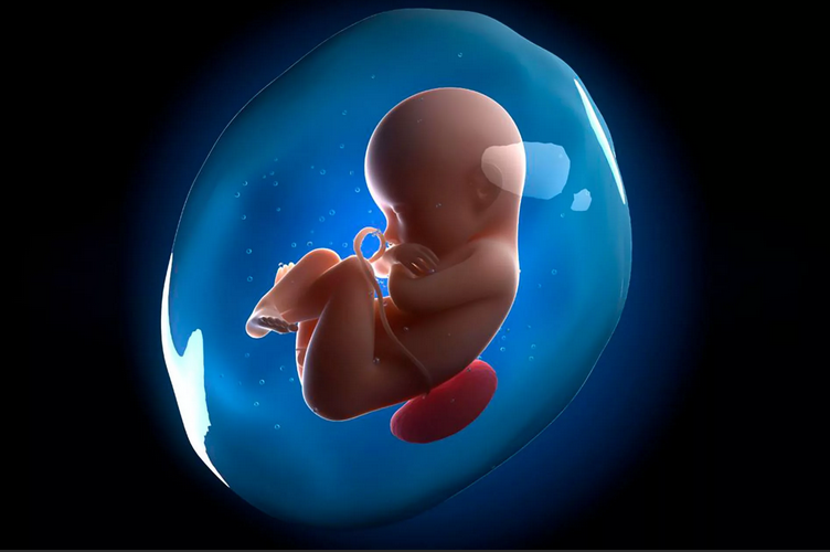 مشکلات مربوط به مایع آمنیوتیک