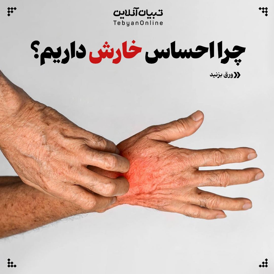  چرا احساس خارش داریم؟