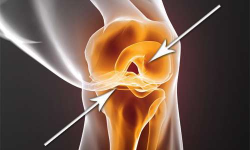 غضروف‌سازی با دارو؛ خیال یا واقعیت‌؟