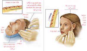 هشدار درباره جوان‌سازی صورت
