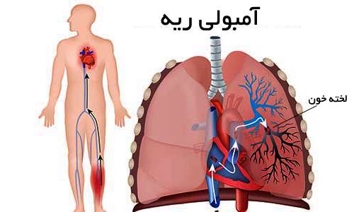 چرا خون یکدفعه لخته می‌شود؟