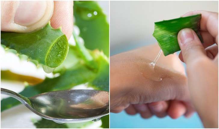  از بین بردن خال‌های پوست به روش خانگی