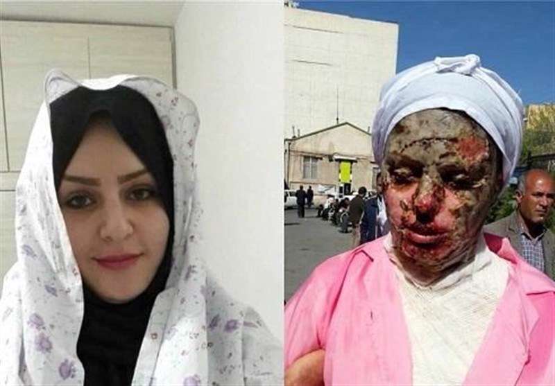 تحقیقات پرونده اسیدپاشی اخیر 