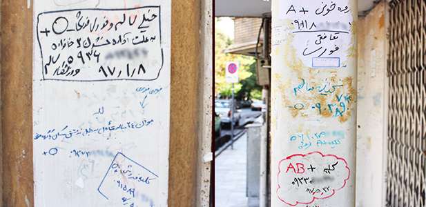 فروش کلیه؛ تدبیری برای گذران زندگی، امیدی برای بهبود اوضاع