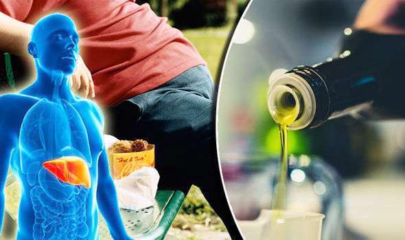 غذاهای مضر برای کبد چرب را بشناسید