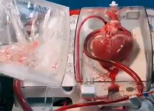 دستگاهی که قلب را زنده نگه می دارد