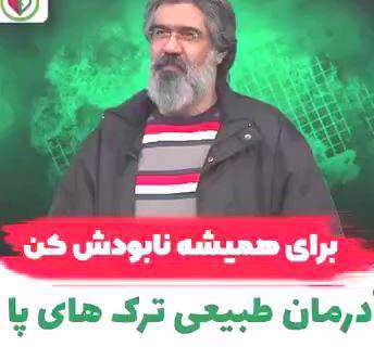 درمان بی نظیر برای ترک کف پا