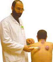 آیا پزشکان با حجامت موافقند؟