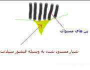 پوشاندن شیار دندان ها