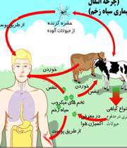 سیاه زخم چیست؟