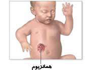 درباره ماه گرفتگی چه می‌ دانید؟