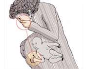 بیماری صبحگاهی یا ویار - Morning Sickness بیماری صبحگاهی یا ویار - Morning Sickness