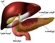 التهاب لوزالمعده (پانکراتیت)