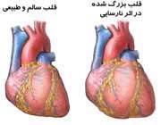 عملکرد ضعیف قلب