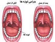در اين 7 مورد شال‌گردن بيندازيد