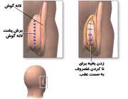 جراحی زیبایی گوش هم داریم؟