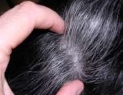 موهايي كه زود سفيد مي‌شوند