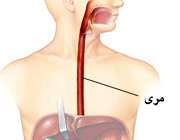 در مري چه خبر است؟