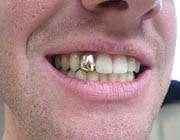 چرا طلا این‏قدر ارزشمند است؟