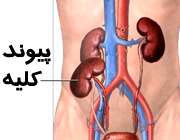 اطلاعاتی درباره ی بیماری های کلیوی