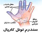 مچ درد خانم های خانه دار 