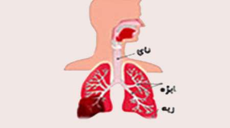 اندازه گیری حجم ریه 