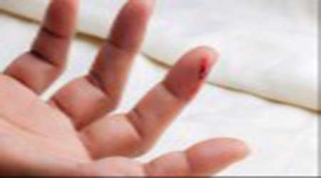 چسب زخم التیام دهنده زخم – جلسه سوم