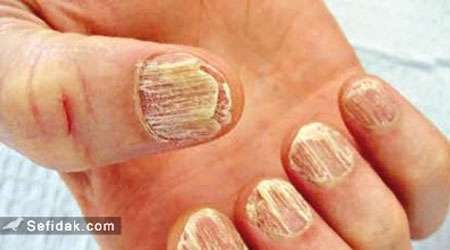 ساخت لاک تقویت کننده ی ناخن با استفاده از پوست تخم مرغ