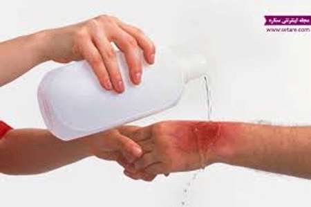 طراحی و ساخت افشانه التیام دهنده سوختگی ناشی از اسید با استفاده از منابع طب سنتی