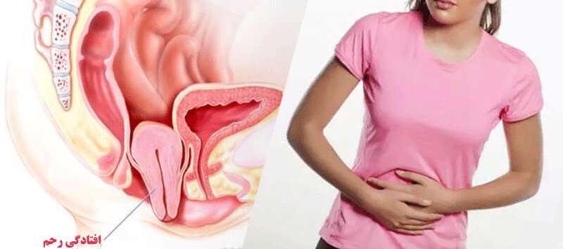  دلایل افتادگی رحم در خانم ها 