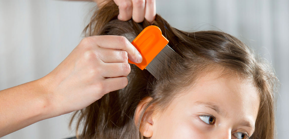 روش های درمان سریع شپش موی سر