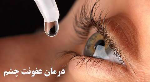  عفونت چشم چیست و چگونه درمان می شود؟