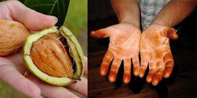 روش های از بین بردن سیاهی ناشی از گردو