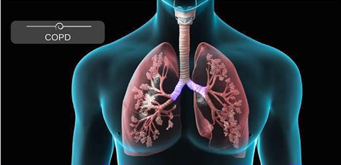 چرا پزشک برای شما اجاره دستگاه اکسیژن ساز تجویز میکند؟